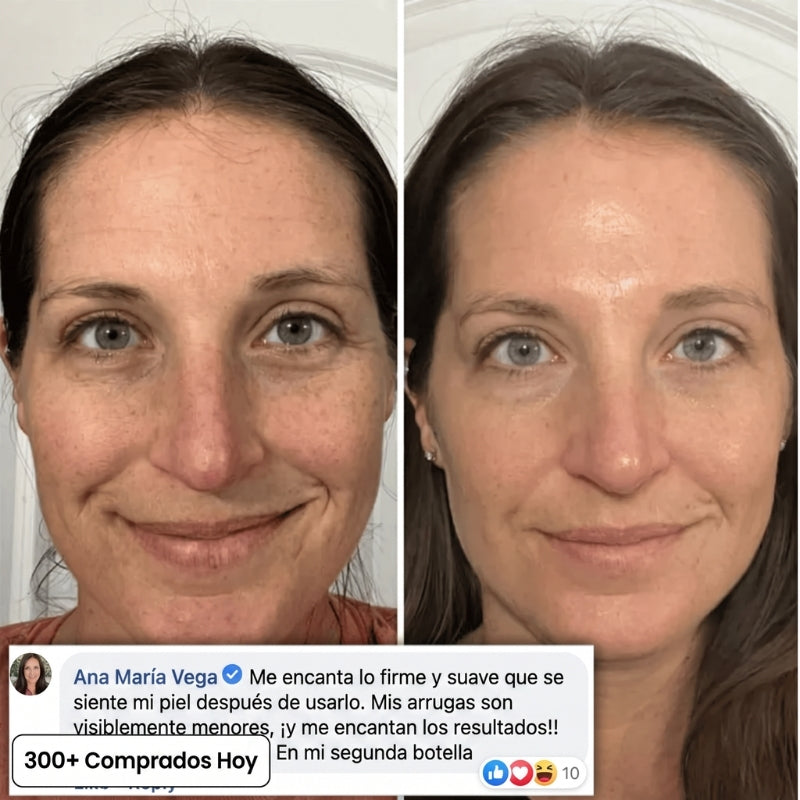 Transforma Arrugas, Líneas Finas y Pliegues de Cansancio de Forma Natural