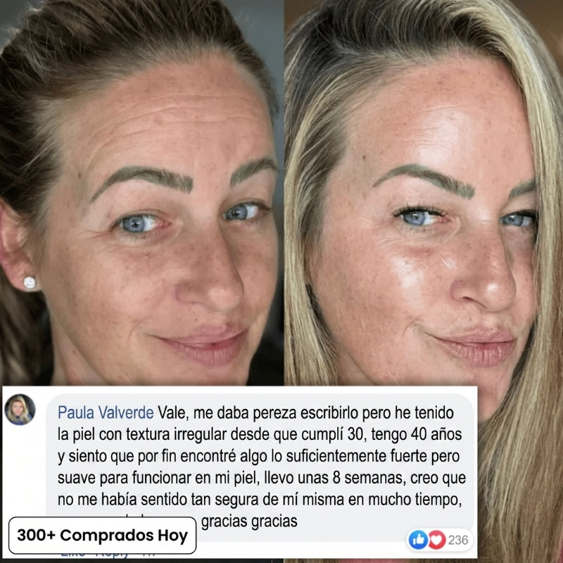 Transforma Arrugas, Líneas Finas y Pliegues de Cansancio de Forma Natural