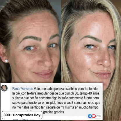 Transforma Arrugas, Líneas Finas y Pliegues de Cansancio de Forma Natural
