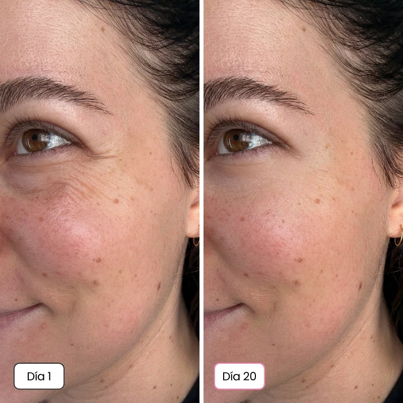 <p>Mujeres Reales. Resultados Sin Filtros.</p>