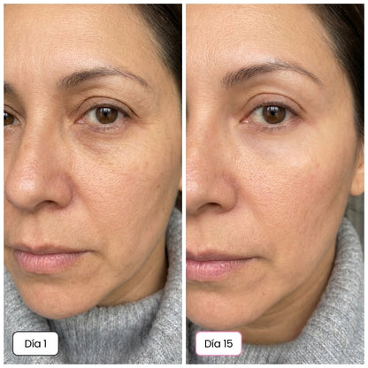 El Secreto Coreano 5 en 1: Piel Luminosa y Firme - Desde el día 1