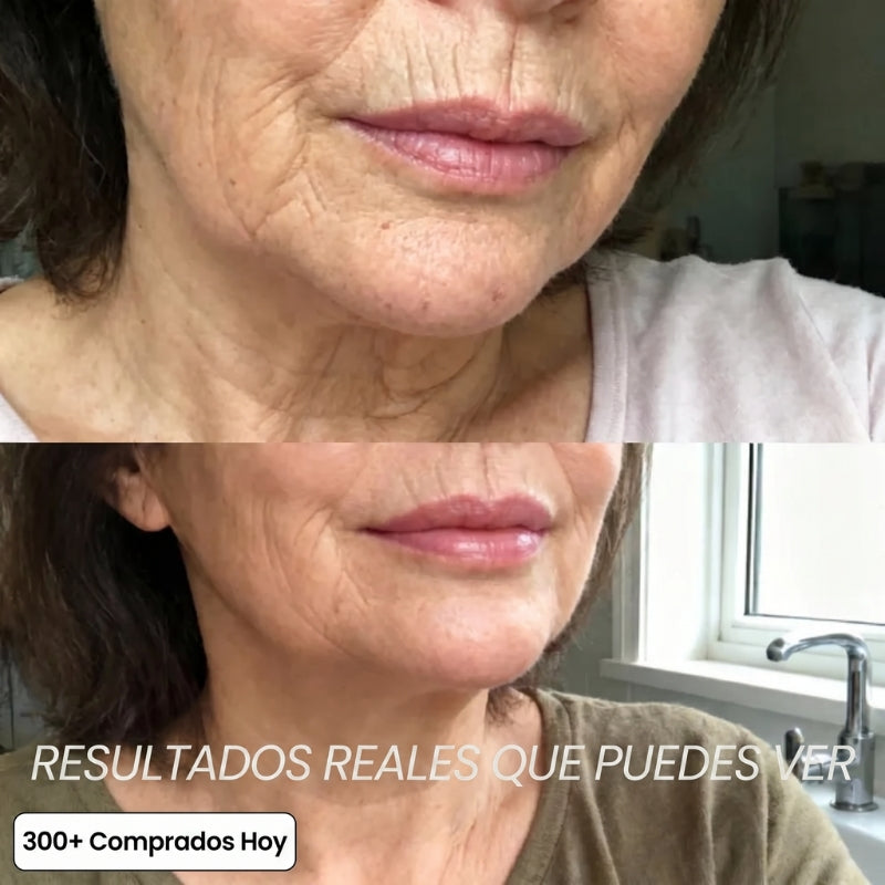 Transforma Arrugas, Líneas Finas y Pliegues de Cansancio de Forma Natural