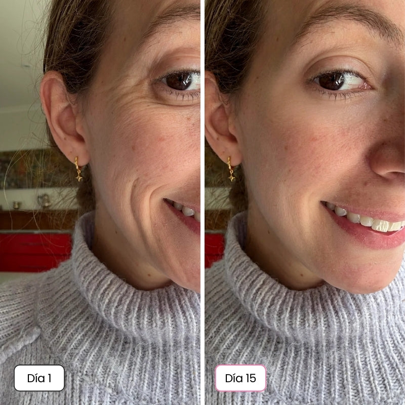 <p>Mujeres Reales. Resultados Sin Filtros.</p>