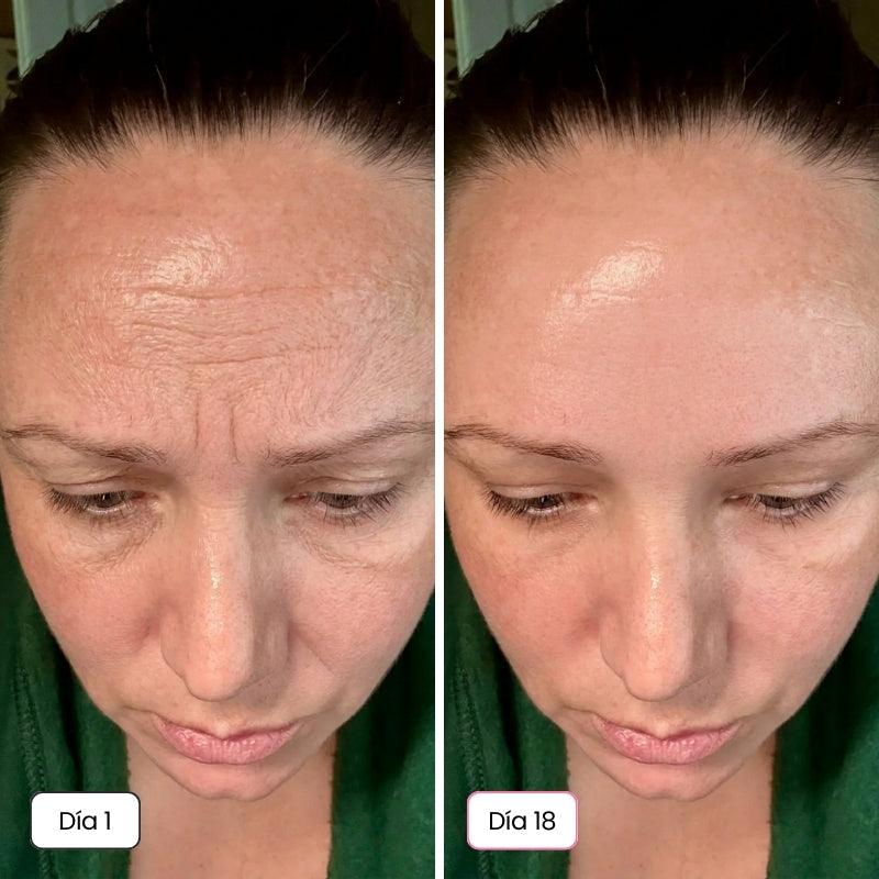 <p>Mujeres Reales. Resultados Sin Filtros.</p>