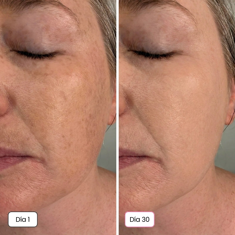 <p>Mujeres Reales. Resultados Sin Filtros.</p>