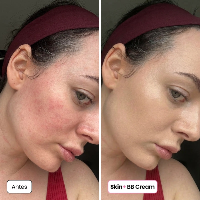 <p>Mujeres Reales. Resultados Sin Filtros.</p>