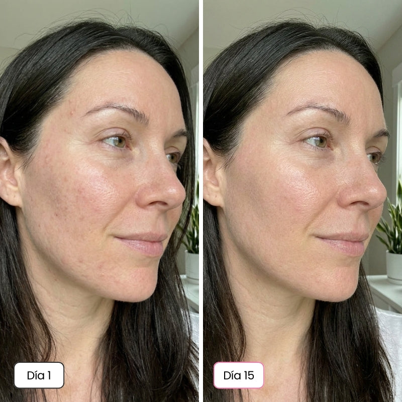 <p>Mujeres Reales. Resultados Sin Filtros.</p>
