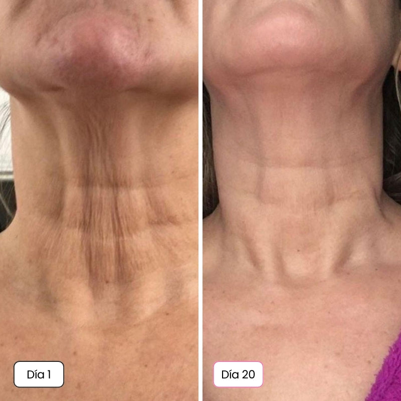 <p>Mujeres Reales. Resultados Sin Filtros.</p>