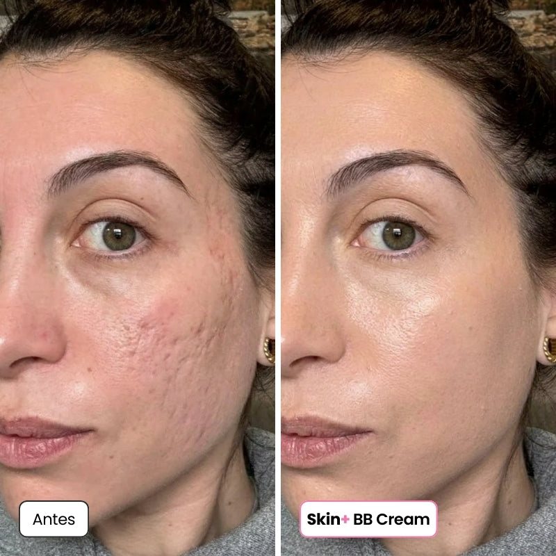 <p>Mujeres Reales. Resultados Sin Filtros.</p>