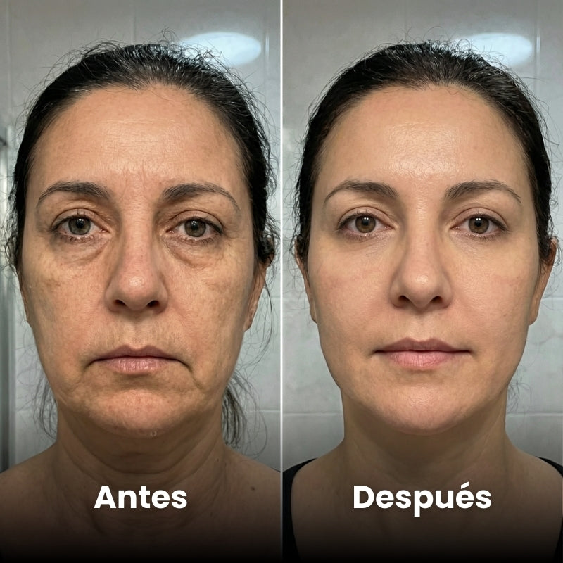 <p>Mujeres Reales. Resultados Sin Filtros.</p>