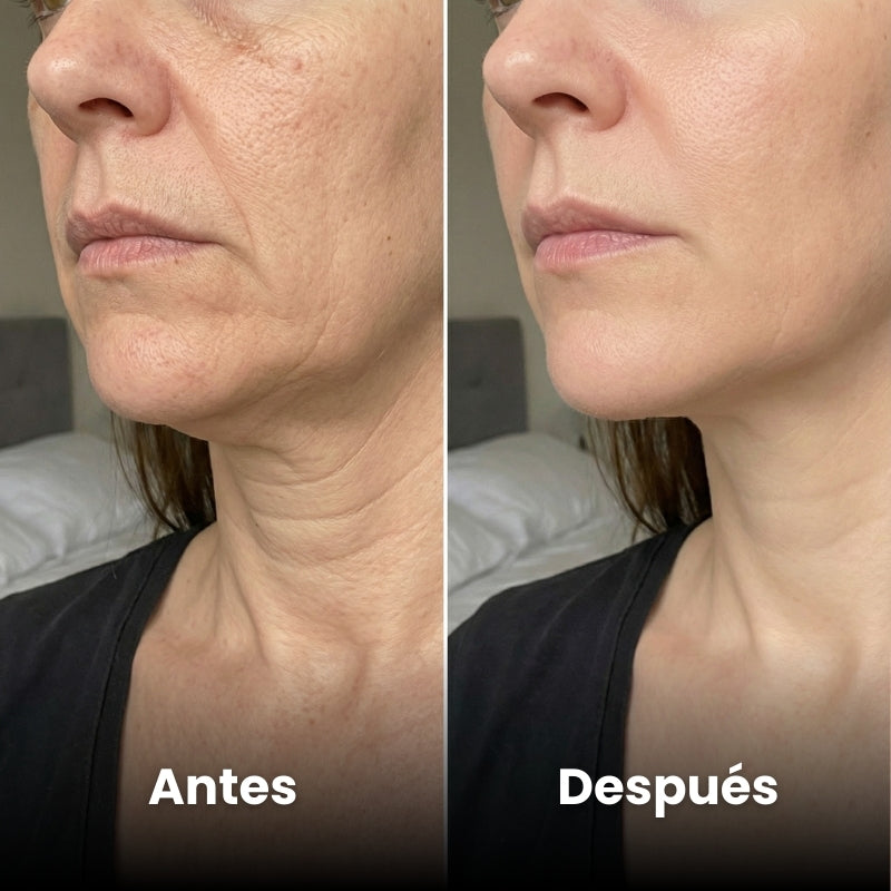 <p>Mujeres Reales. Resultados Sin Filtros.</p>