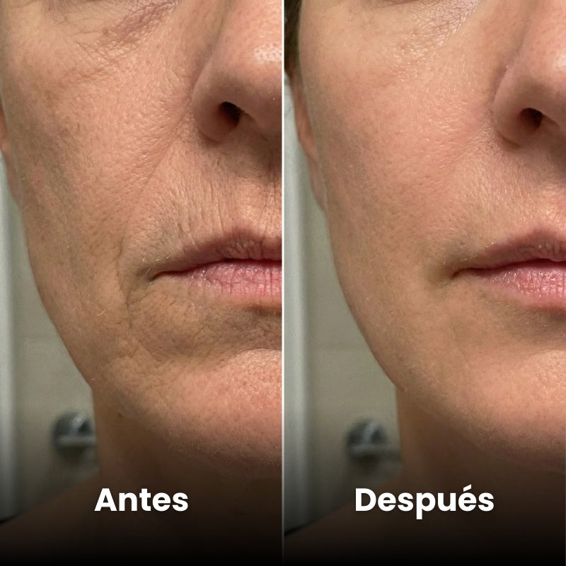 <p>Mujeres Reales. Resultados Sin Filtros.</p>