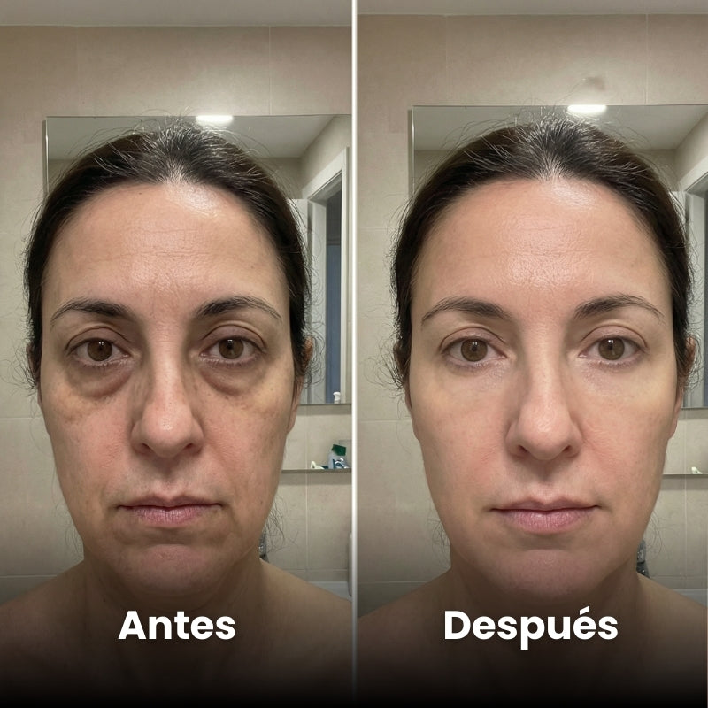 <p>Mujeres Reales. Resultados Sin Filtros.</p>