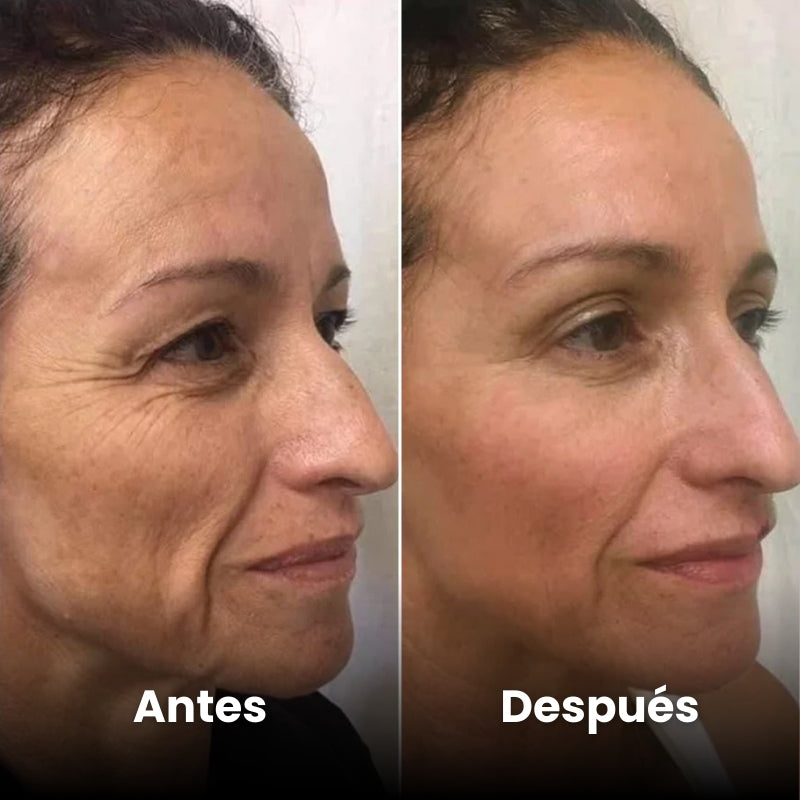 <p>Mujeres Reales. Resultados Sin Filtros.</p>