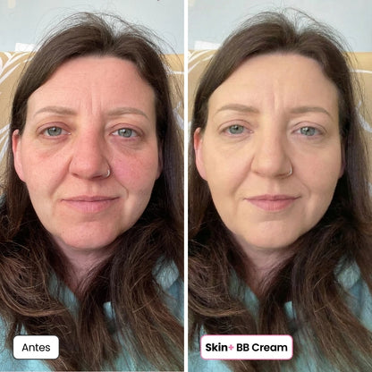 Skin+ BB Cream™ | El Secreto de una Piel Uniforme y Radiante