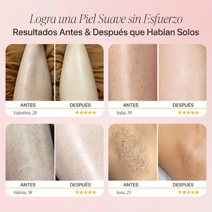 Rasuradora SKIN+ 2 en 1: Piel Suave Sin Granitos, Cortes ni Irritación — Desde el Primer Uso